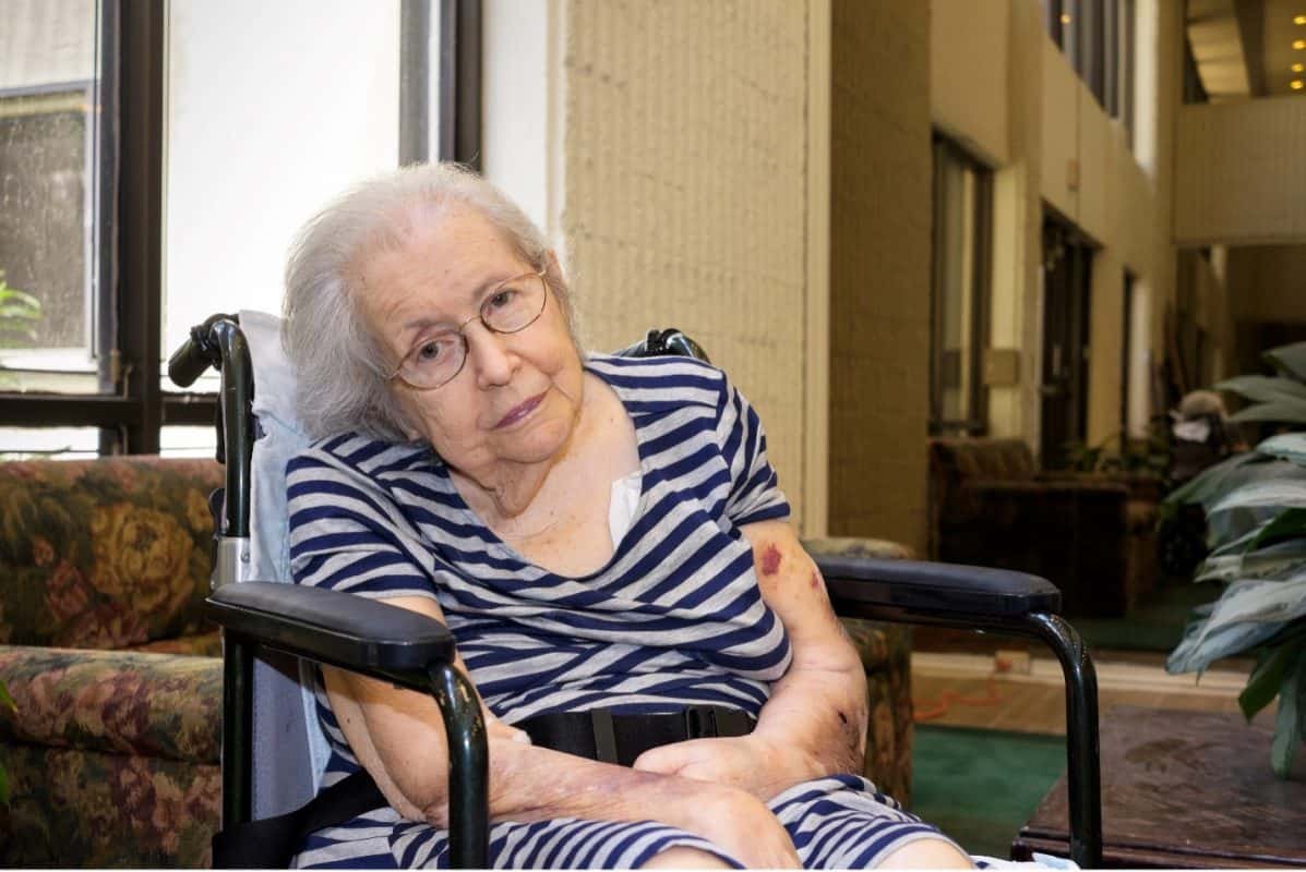 Post-Stroke Conditions In The Geriatric Population