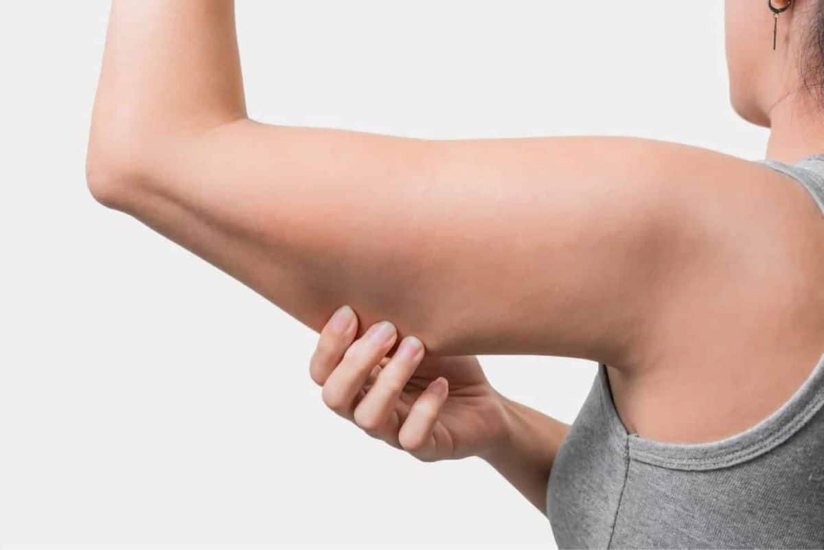 Say Goodbye To Arm Fat: Tips To Reduce And Eliminate Unwanted Flab