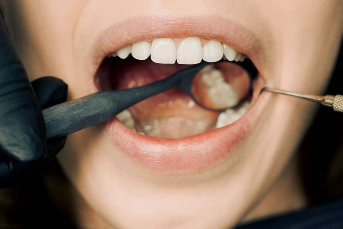 Unlock Savings With Your Smile: How Dental Discount Plans Can Help You Cut Costs