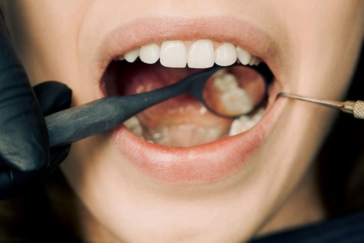 Unlock Savings With Your Smile: How Dental Discount Plans Can Help You Cut Costs